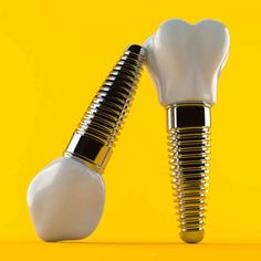 Dental Implants in Aberdeen